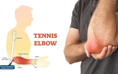 Tennis Elbow the causes & the treatment